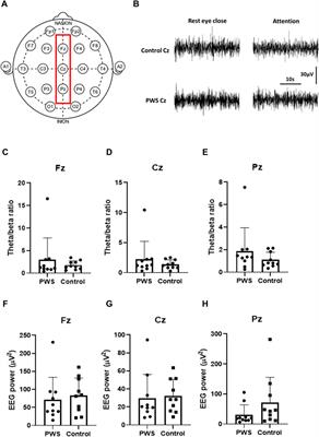 Dynamic Changes in the Quantitative Electroencephalographic Spectrum During Attention Tasks in Patients With Prader–Willi Syndrome